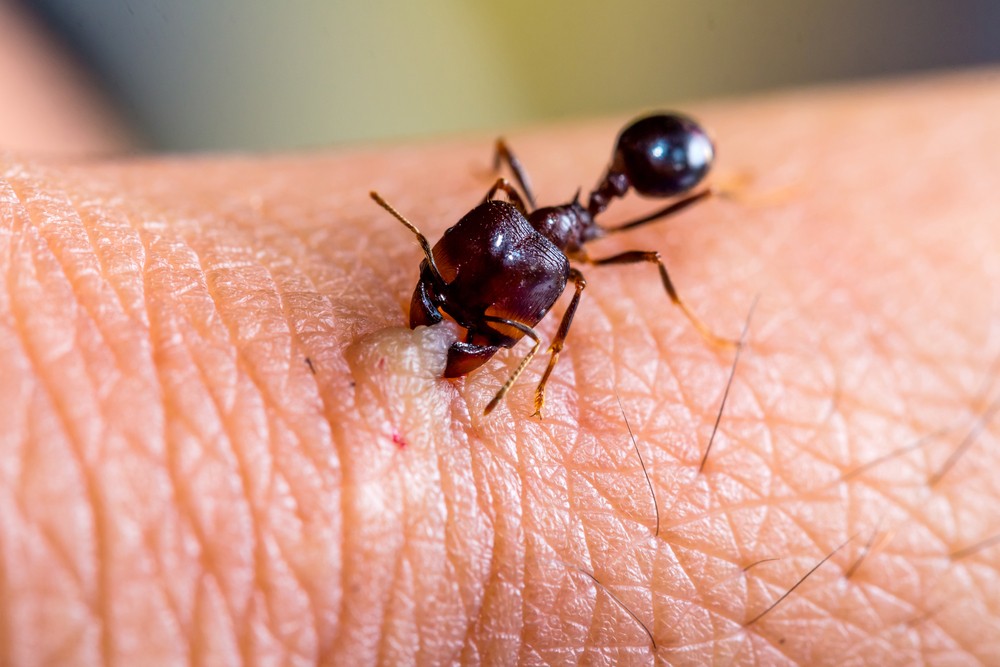 Πώς δαγκώνουν τα μυρμήγκια;
