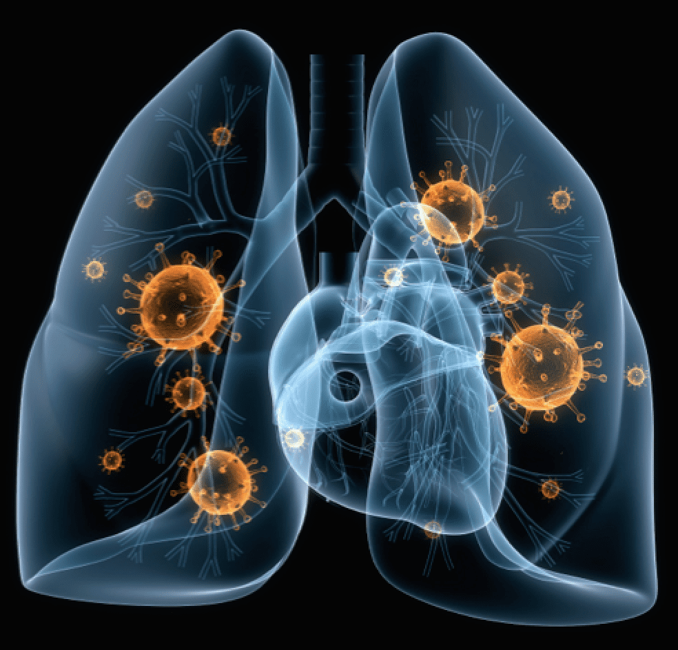 Astma Bronxitin Simptomları Nələrdir