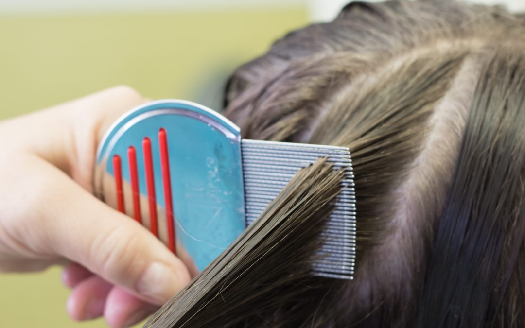 Как да премахнете гнидите от косата без гребен