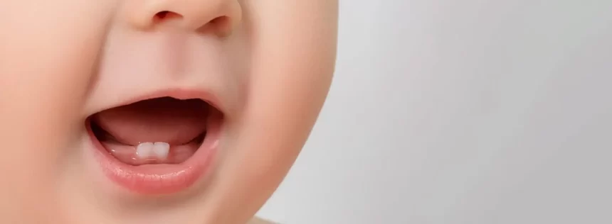 Lücke in den Zähnen