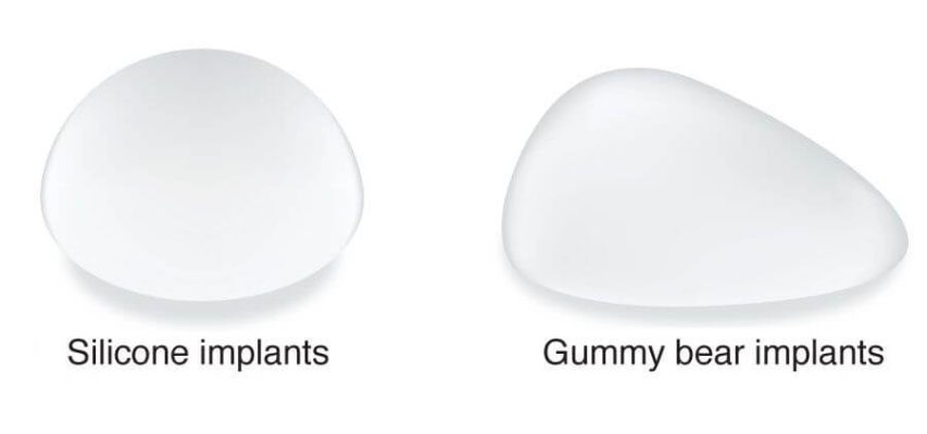 Gummy Bear имплантаттары