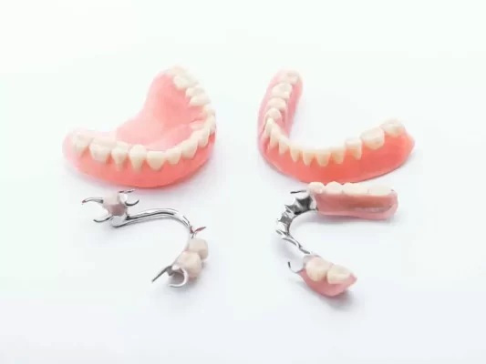 दंत प्रत्यारोपण का विकल्प