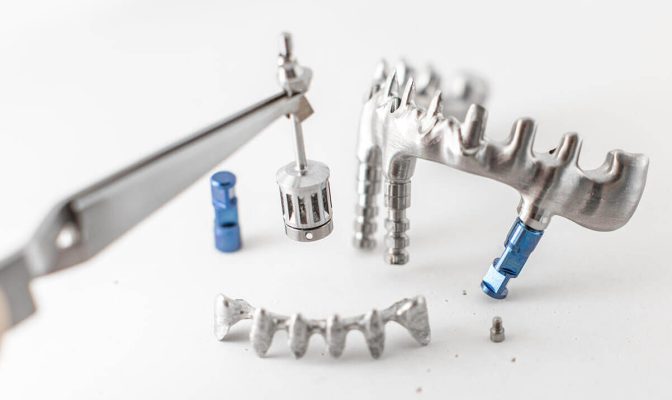 Врсте трошкова зубних имплантата