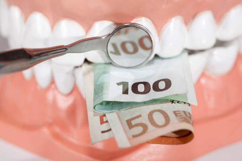 Typy nákladov na zubné implantáty