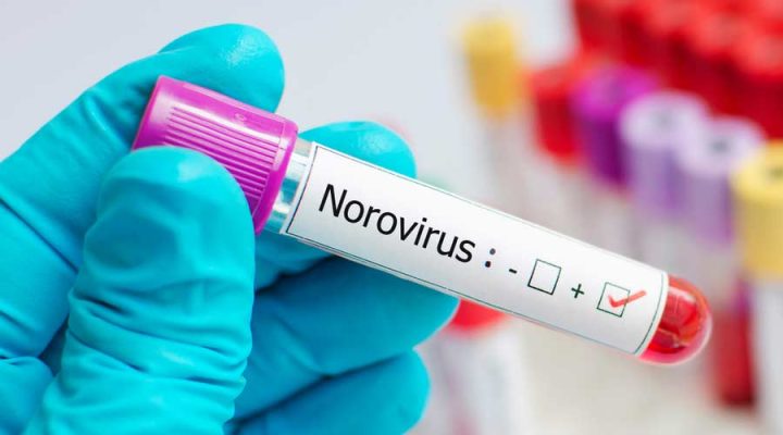 Норовирус 2023