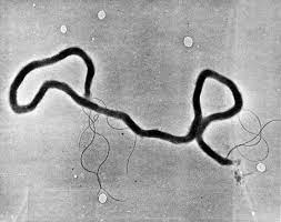 Varför syfilisfall ökar i en alarmerande takt i Kanada